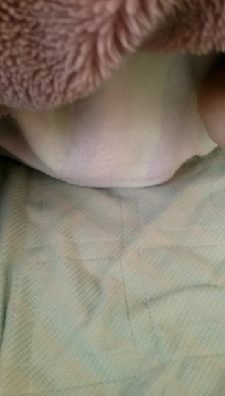 AVPEEP 